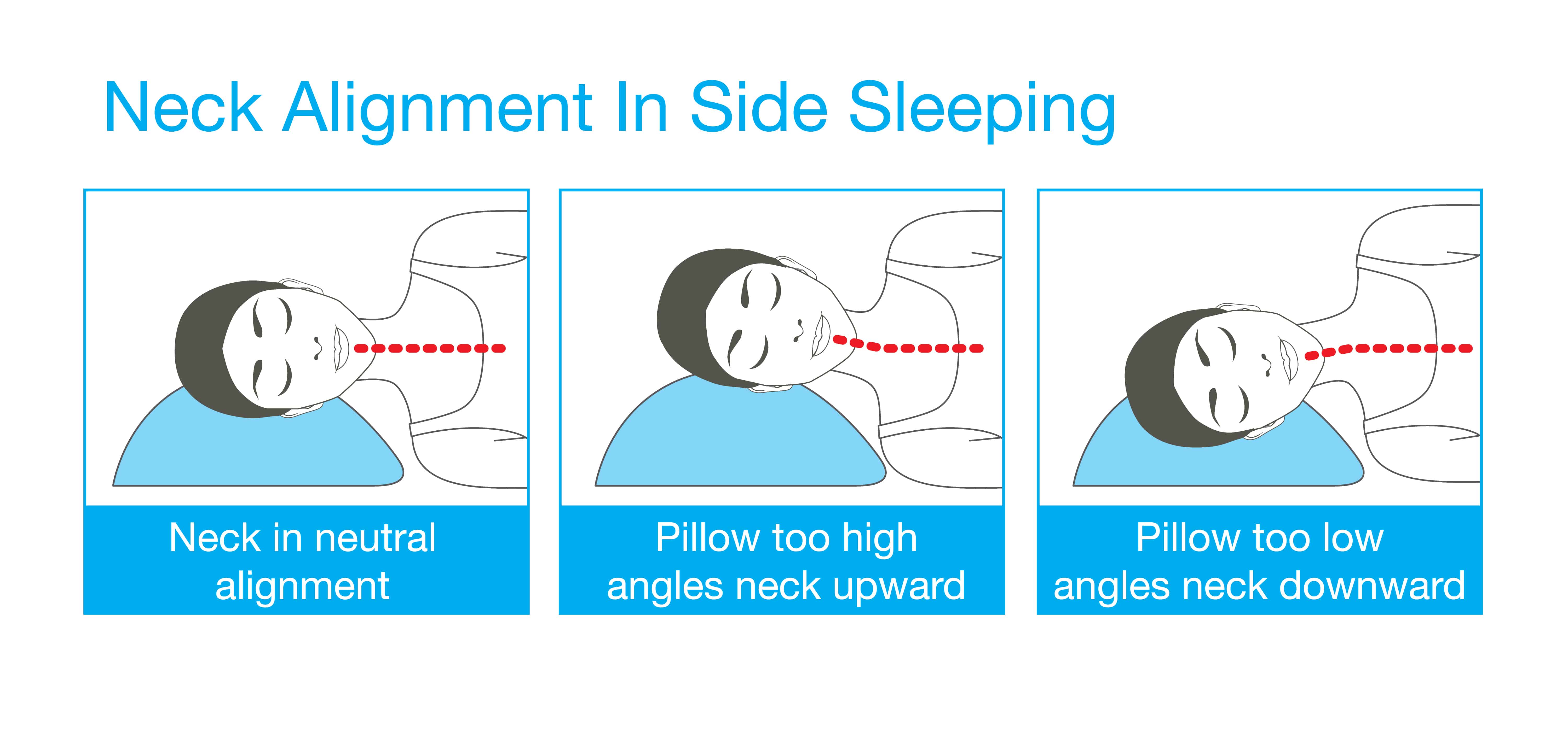 Nasal Valve For Sleep Apnea